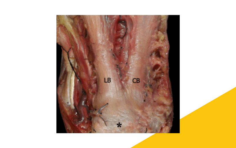 14. Musculatura intrinseca pie ecografia tempo formacion.png